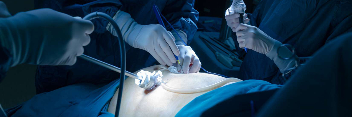 How Does Laparoscopy Help In Infertility